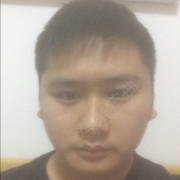 刘应佳